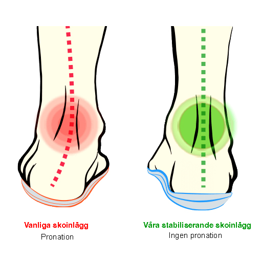 Pronation halvsula, hålfotsinlägg