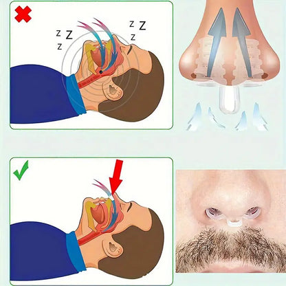 Anti-snark näsvidgare - För bättre andning och snarkreducering under sömn