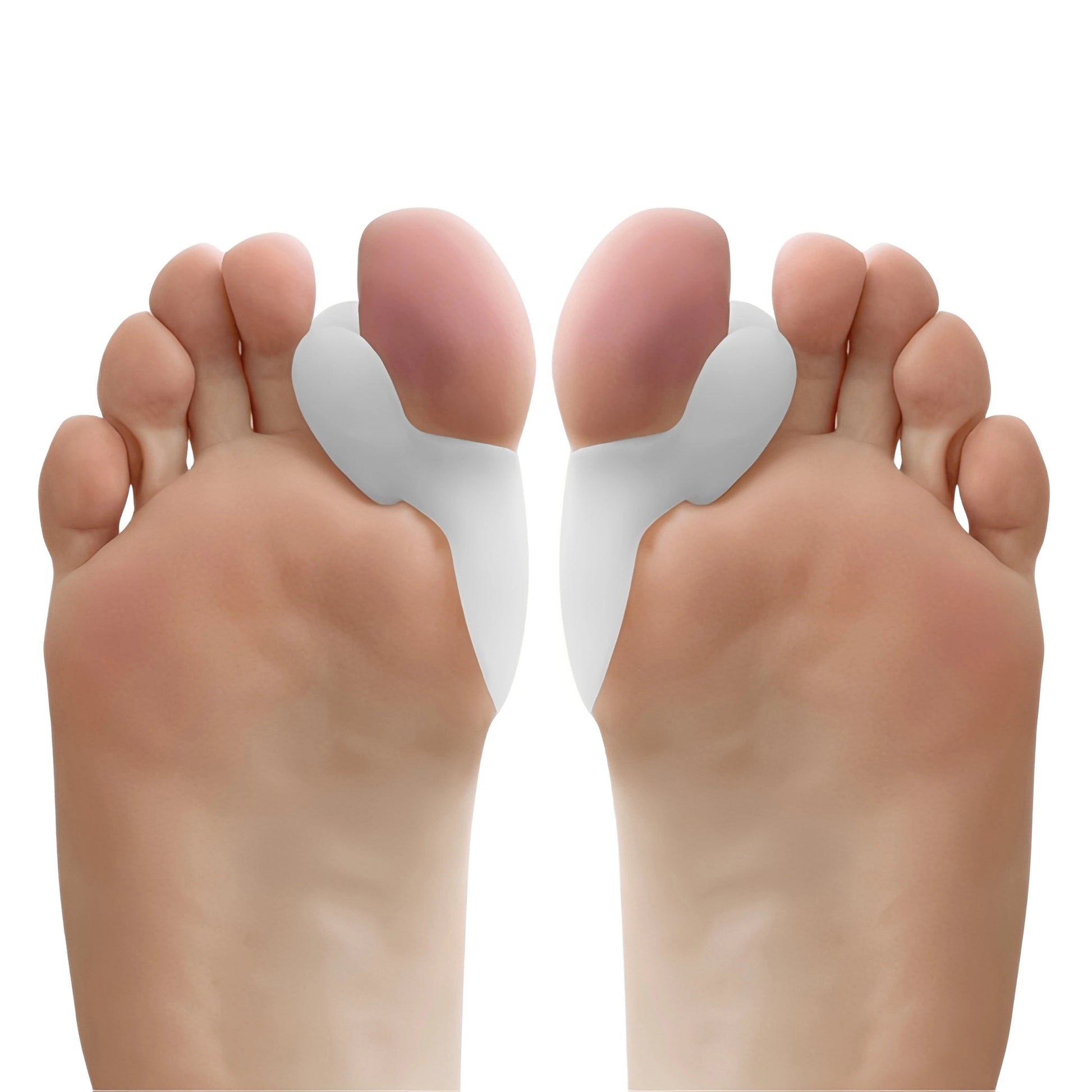 Illustration som visar hur tåseparatorn skapar avstånd mellan tårna