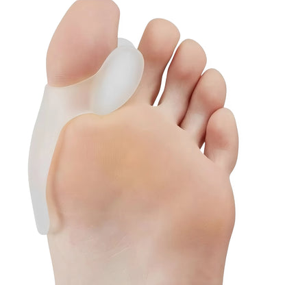 Tåsepareraren visad underifrån