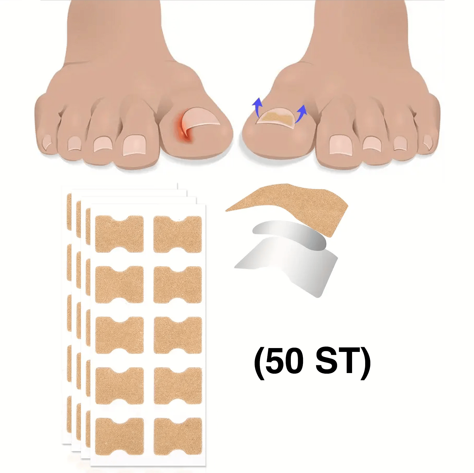 Korrigeringstejp som används vid nageltrång på tå