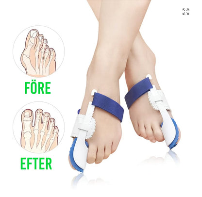 Jämförelse som visar stortåns position före och efter användning