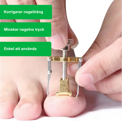 Verktyg som korrigerar nageltrång applicerat på stortån, med text som beskriver fördelar.